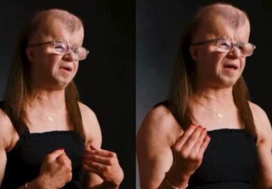 Mulher com síndrome