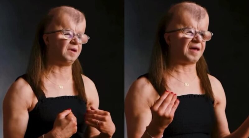 Mulher com síndrome